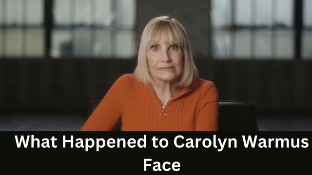 What Happened to Carolyn Warmus Face