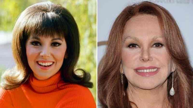 Marlo Thomas Plastic Surgery