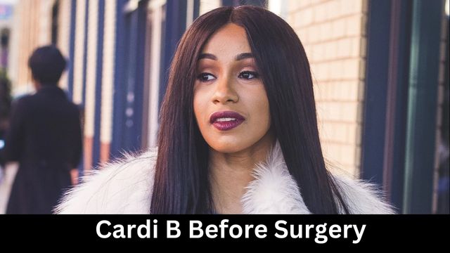 Cardi B Before Surgery