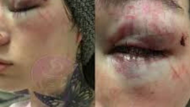 Bhad Bhabie Drops Shocking Video of Alleged Domestic Abuse by Estranged Boyfriend